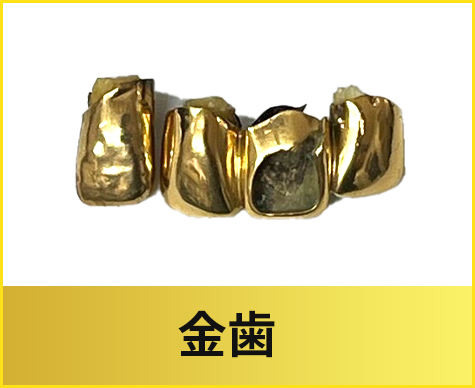 金歯